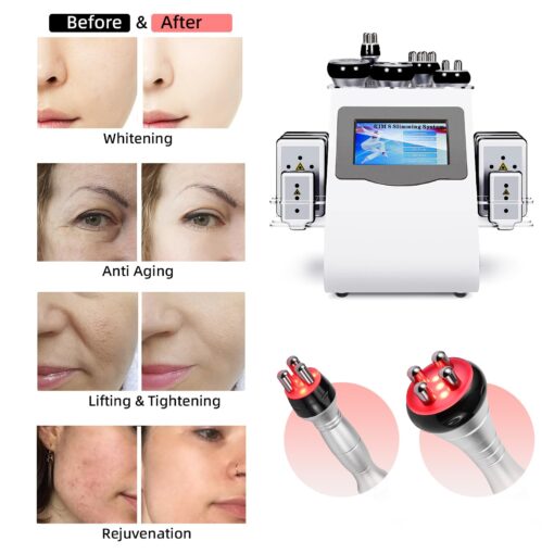 Body Massager Multifunction Beauty Device Use - Image 5